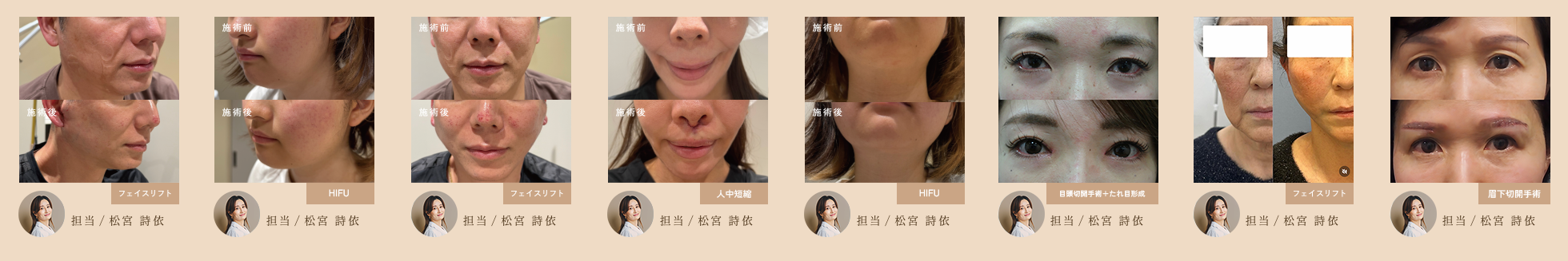 症例写真のスライダー