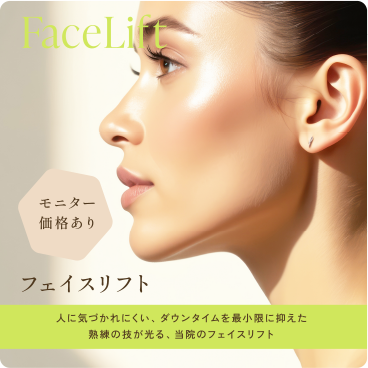 フェイスリフト